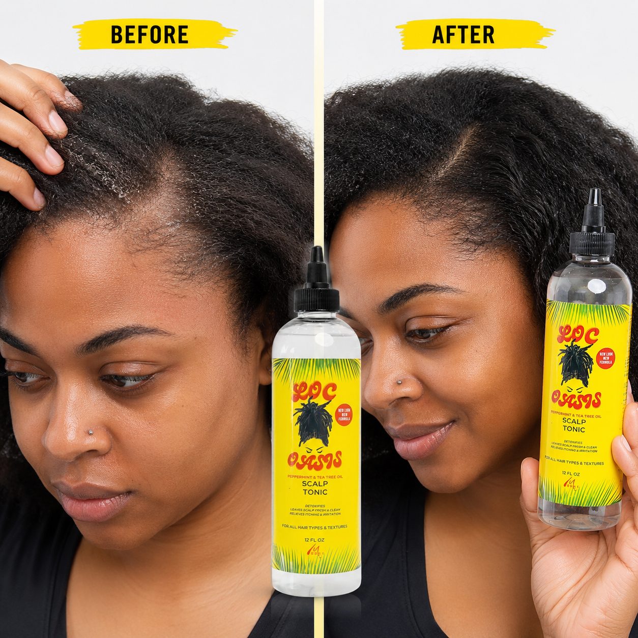 Scalp Tonic 12oz - Image 3
